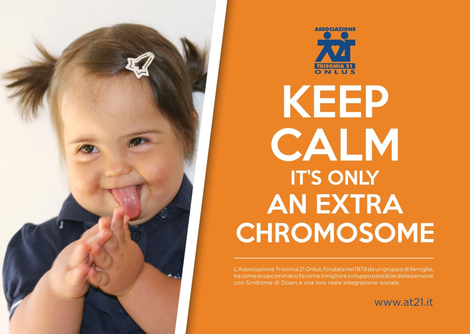 Keep Calm Its Only An Extra Chromosome